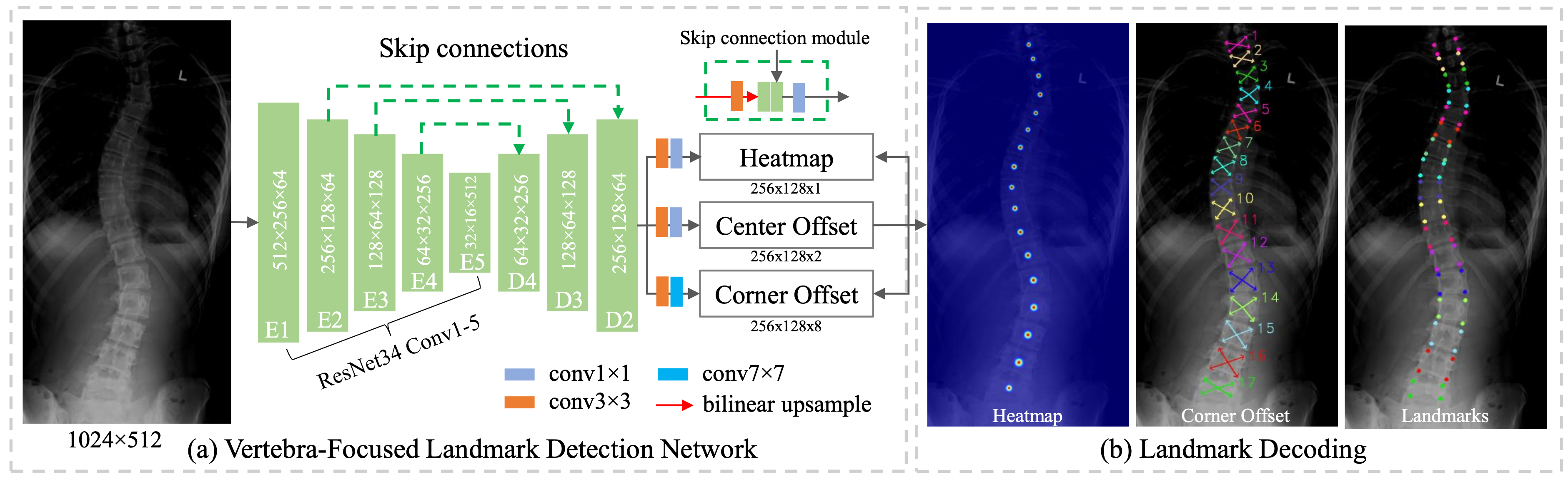 Concept of Vertebra-Focused Landmark Detection for Scoliosis Assessment